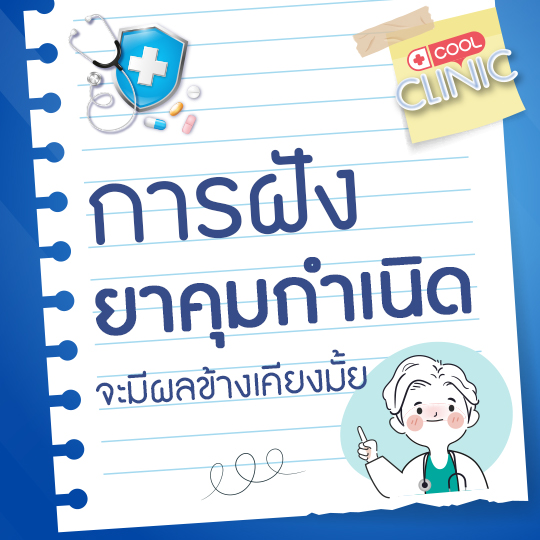 การฝังยาคุมกำเนิด จะมีผลข้างเคียงมั้ยคะหมอเจี๊ยบ?